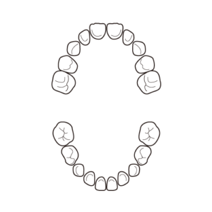 乳歯の歯列